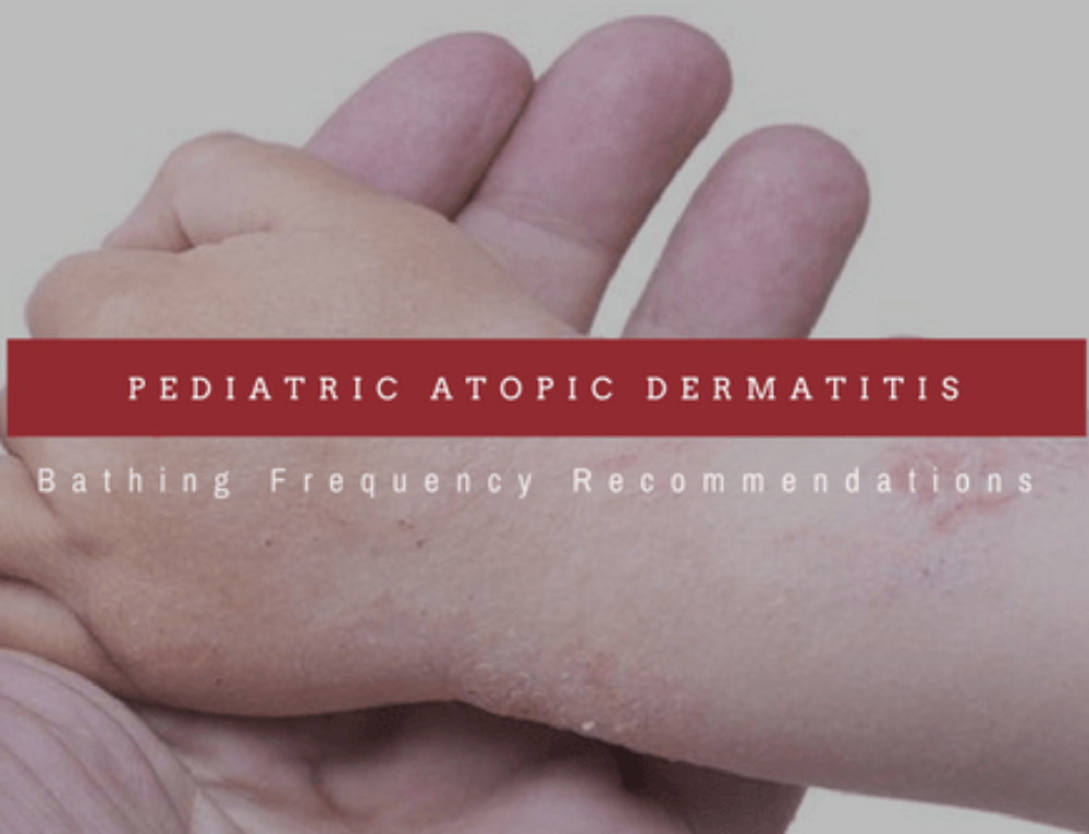 Bathing Frequency In Pediatric Atopic Dermatitis?