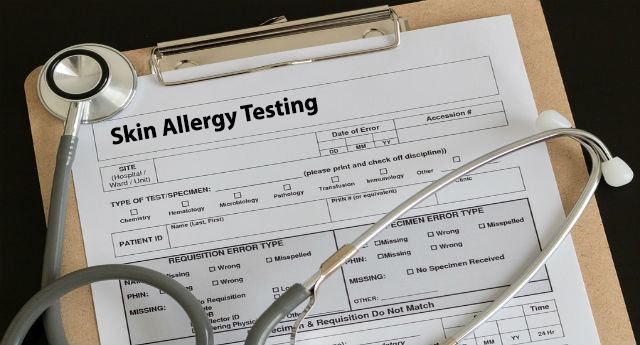 skin allergy testings near chandler