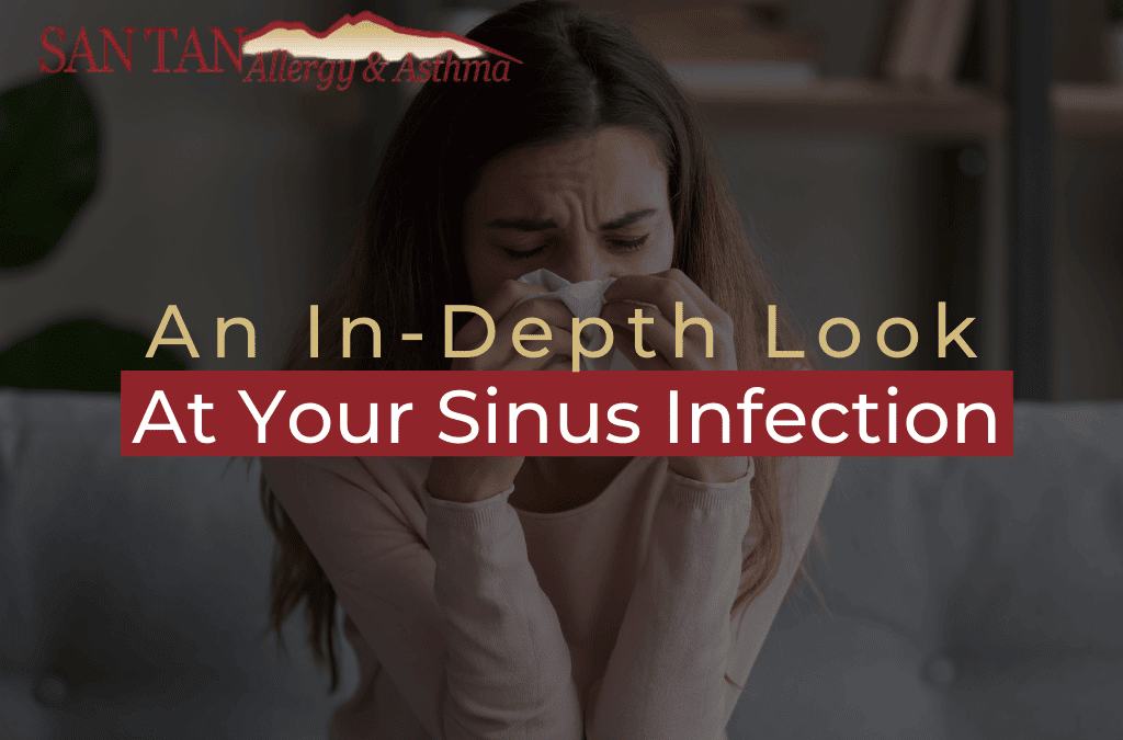 An In-Depth Look At Your Sinus Infection