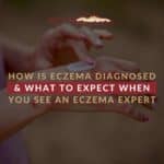 How Is Eczema Diagnosed & What To Expect When You See an Eczema Expert