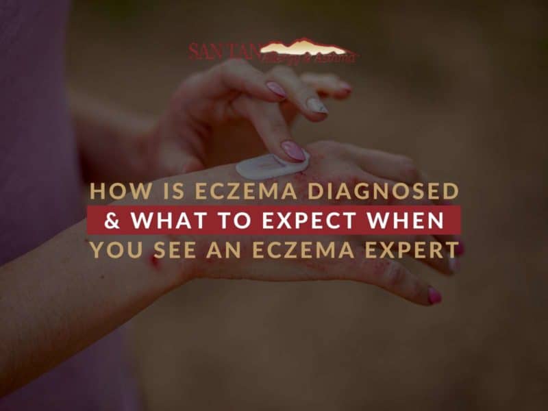 Conditions We Treat San Tan Allergy & Asthma