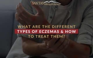 What Are The Different Types Of Eczemas & How To Treat Them