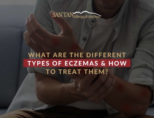 What Are The Different Types Of Eczemas & How To Treat Them?