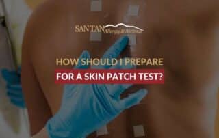 How Should I Prepare For a Skin Patch Test?