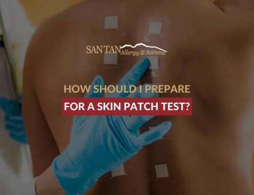 How Should I Prepare For a Skin Patch Test?