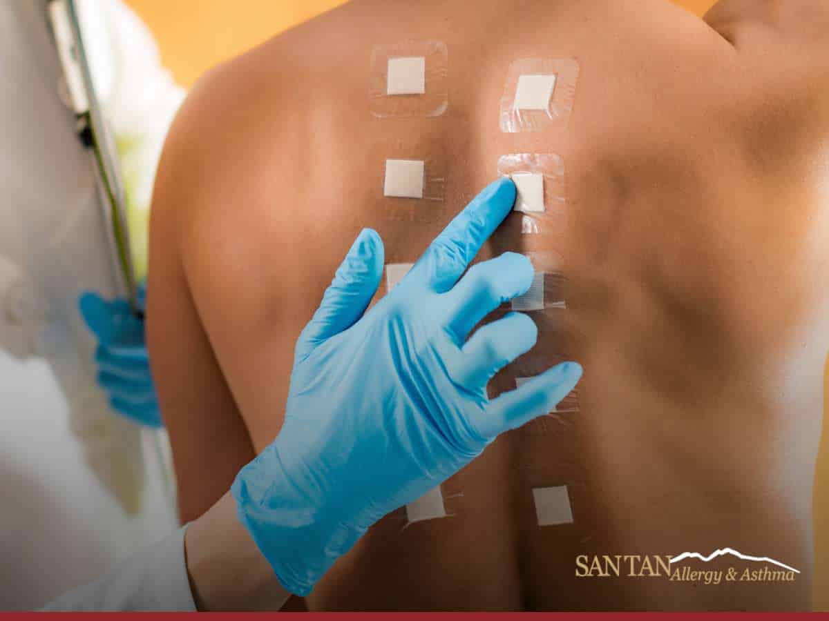 Doctor applying a Skin Patch Test to identify allergic reactions on a patient’s back