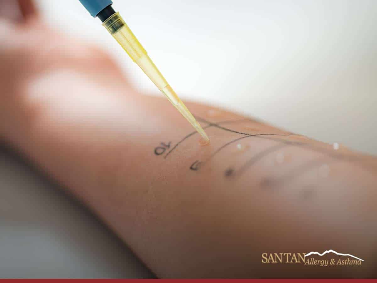 Environmental Skin Testing procedure applying allergens on a patient's arm